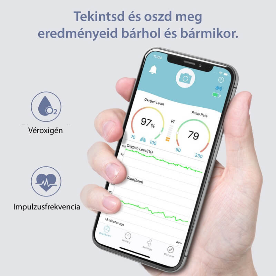 Viatom Baby O2 S2 Légzésfigyelő készülék külső állomással (véroxigénszint, pulzus, mozgás) - Image 4